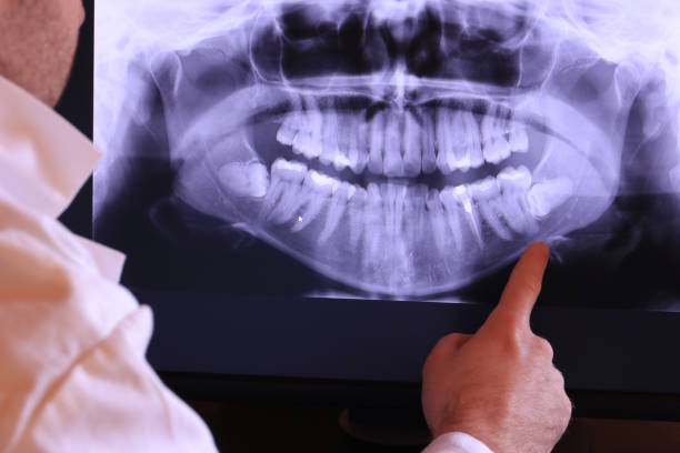 Best Emergency Dental Care for Broken or Chipped Teeth in Wilmer, TX