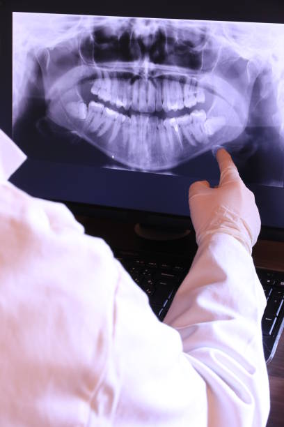 Best Emergency Tooth Extraction in Wilmer, TX