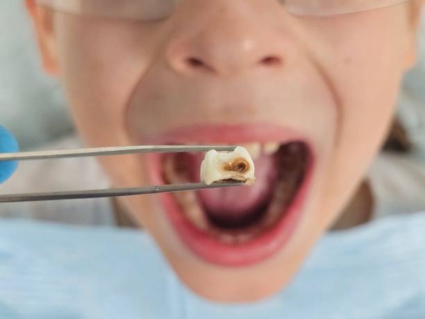 Best Same-Day Emergency Dental Services in Wilmer, TX