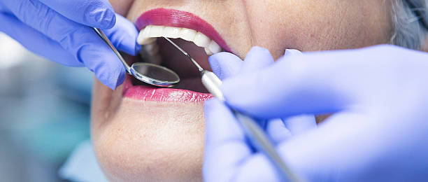 Best Emergency Treatment for Dental Infections or Abscesses in Wilmer, TX